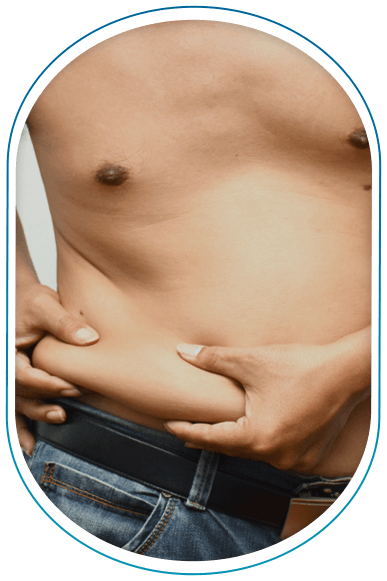 Quel est le résultat de la liposuccion chez l’homme ?